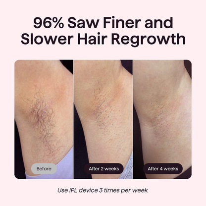 Bare It Without Roller